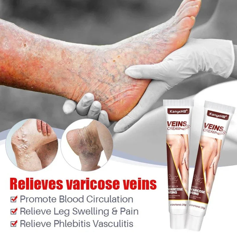 Effective Vein Repair Cream Leg Vein Bulge Pain Maikang Leg Care  Crema Para Blanquear La Cara Skin Whitening Cream 발톱무좀