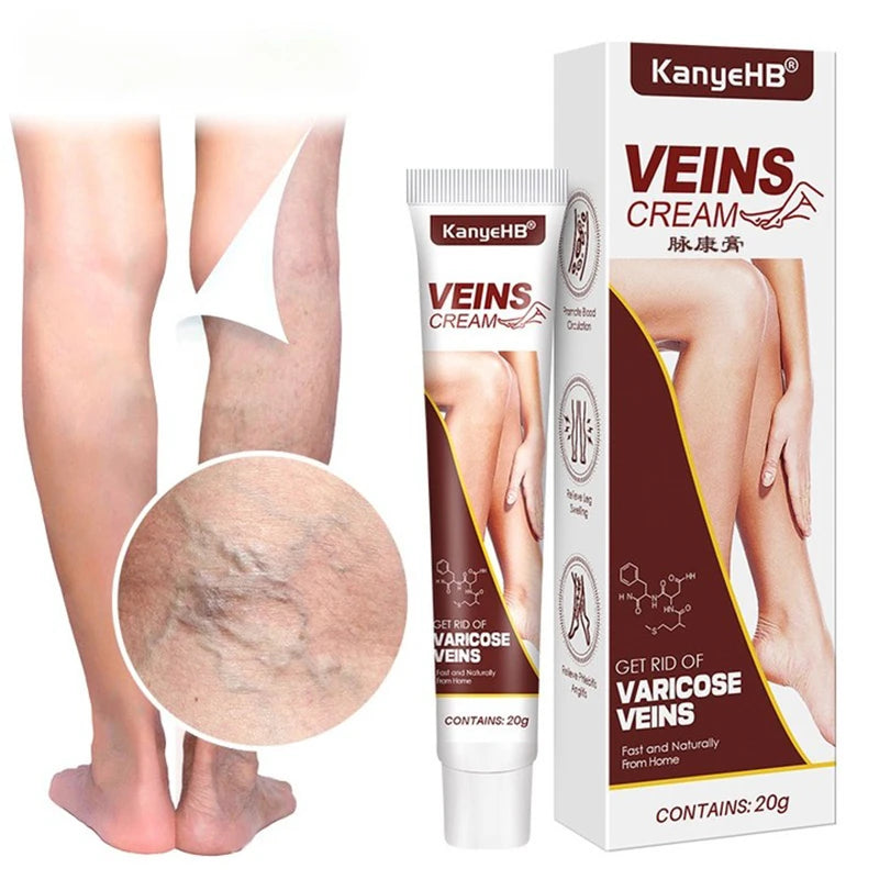 Effective Vein Repair Cream Leg Vein Bulge Pain Maikang Leg Care  Crema Para Blanquear La Cara Skin Whitening Cream 발톱무좀